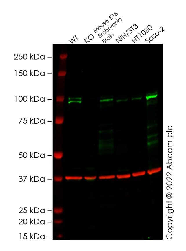 Anti-SATB1 + SATB2 antibody [SATBA4B10] - C-terminal(ab51502)