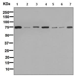 Anti-GARS antibody [EPR7157](AB125008)