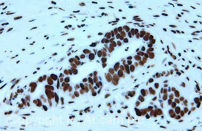 Anti-Histone H3 (acetyl K9) antibody - ChIP Grade(AB10812)