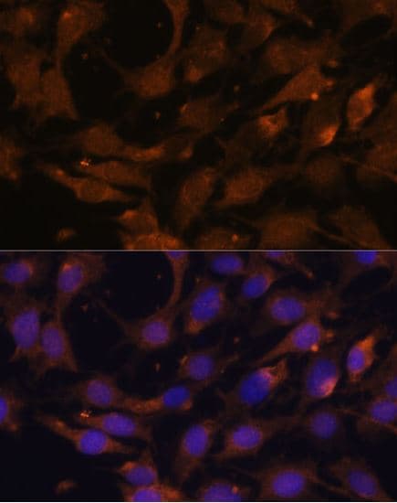 Anti-Ras antibody(AB180772)