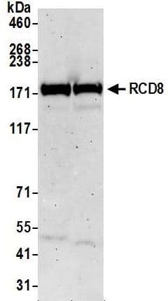 Edc4 Antibody Ab72408  Western Blot Img170181