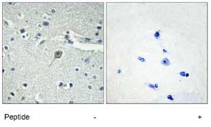 Parathyroid Hormone Receptor 1 Pth1r Antibody Ab75150  Immunohistochemistry Formalin Pfa Fixed Paraffin Embedded Sections Img110633