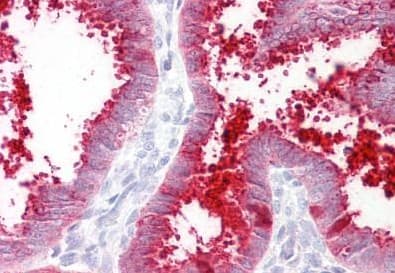 Mmp7 Antibody C Terminal Ab189277  Immunohistochemistry Formalin Pfa Fixed Paraffin Embedded Sections Img115951