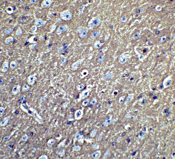 Lmx1b Antibody Ab139736  Immunohistochemistry Formalin Pfa Fixed Paraffin Embedded Sections Img131529
