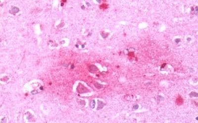 Anti-CRF1/CRHR1 antibody - N-terminal(AB230803)