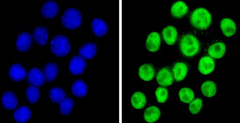 Anti-NCOR2/SMRT antibody(ab5802)