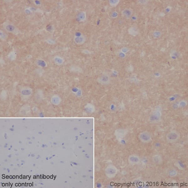 Anti-Alpha-synuclein antibody [EPR20535] - BSA and Azide free(AB225866)