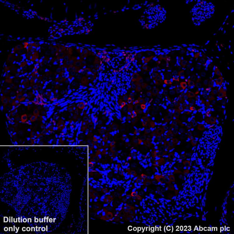 Alexa Fluor 647 Trpv1 Antibody Epr25057 67 Ab313673  Immunohistochemistry Formalin Pfa Fixed Paraffin Embedded Sections Img418125