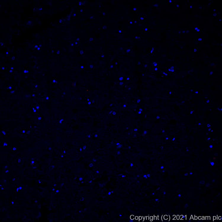 Alexa Fluor® 594 Anti-Osteopontin antibody [EPR21139-316](AB282279)