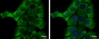 Alpha 1 Microglobulin Antibody Ab153806  Immunocytochemistry Immunofluorescence Img452086