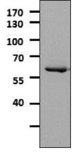 Anti-Tyrosine Hydroxylase antibody - Neuronal Marker(AB112)
