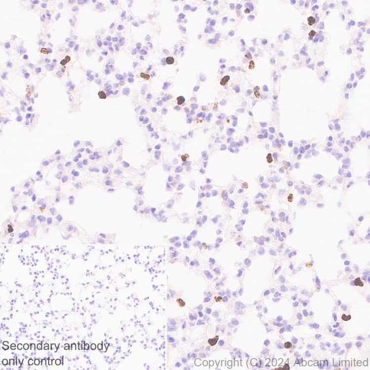 Ykl 40 Chi3l1 Antibody Rm1204 Bsa And Azide Free Ab319165  Immunohistochemistry Formalin Pfa Fixed Paraffin Embedded Sections Img434080