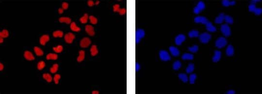 Anti-HMGB1 antibody [EPR3507](AB79823)