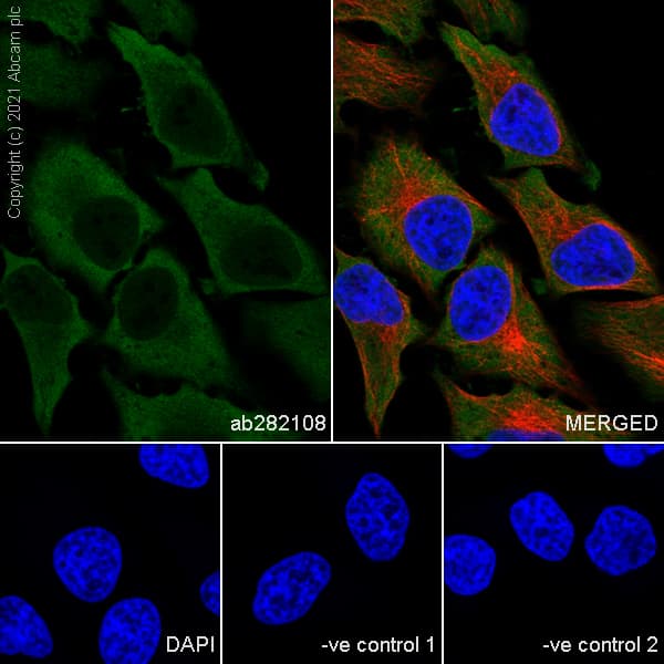 Hsp90 Alpha Antibody 68 Hsp90 Ab282108  Immunocytochemistry Immunofluorescence Img171851