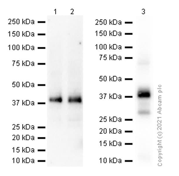 Glycophorin C Gpc Antibody Epr4116 Bsa And Azide Free Ab247712  Western Blot Img174763