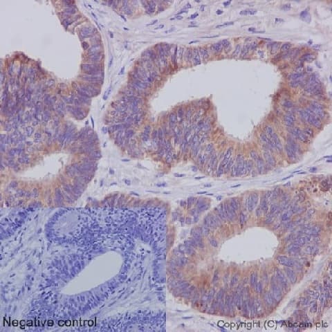 Anti-IKK gamma/NEMO antibody [EPR16629] - BSA and Azide free(AB230832)