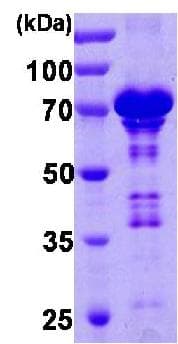 Recombinant Human Chromogranin A protein(AB85486)