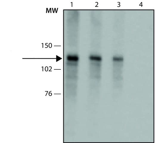 Anti-Collagen I antibody [COL-1](AB6308)