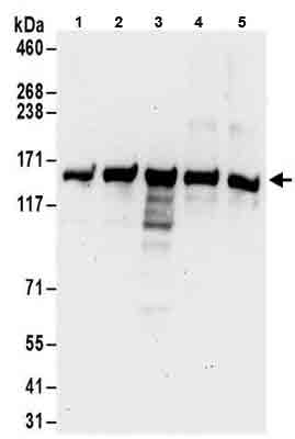 Anti-PFAS antibody(AB186013)