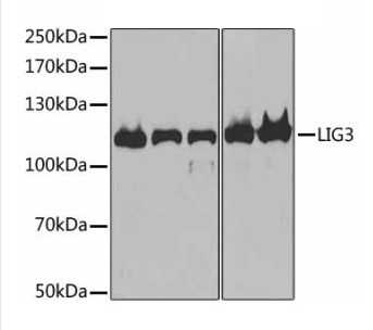 Anti-DNA Ligase III/LIG3 antibody(AB185815)