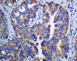 Gamma Adaptin Antibody Epr9875b Bsa And Azide Free Ab249398  Immunohistochemistry Formalin Pfa Fixed Paraffin Embedded Sections Img126938