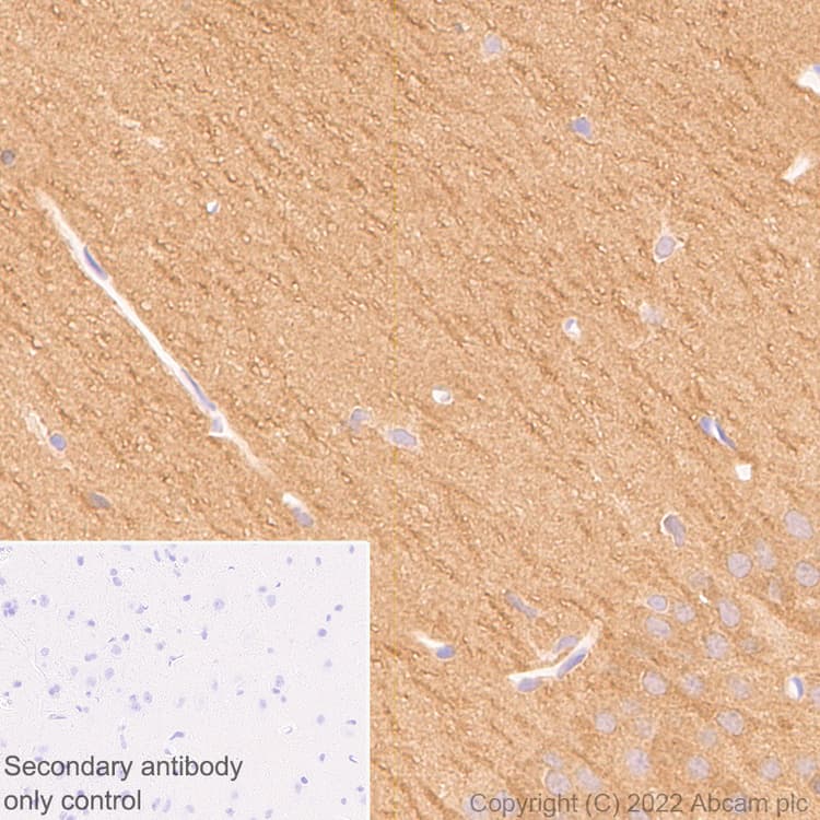 Anti-PAK1 antibody [EPR26067-45](AB302506)