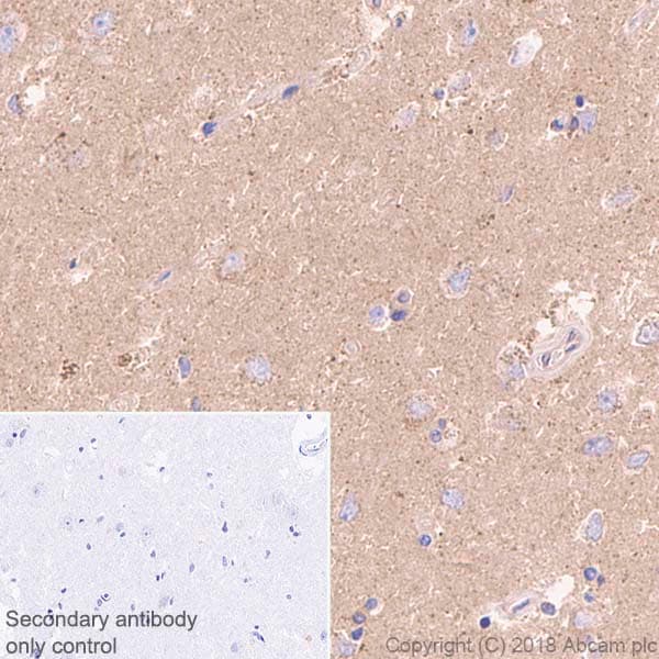 Anti-Rab5 antibody [EPR21801] - Early Endosome Marker(AB218624)