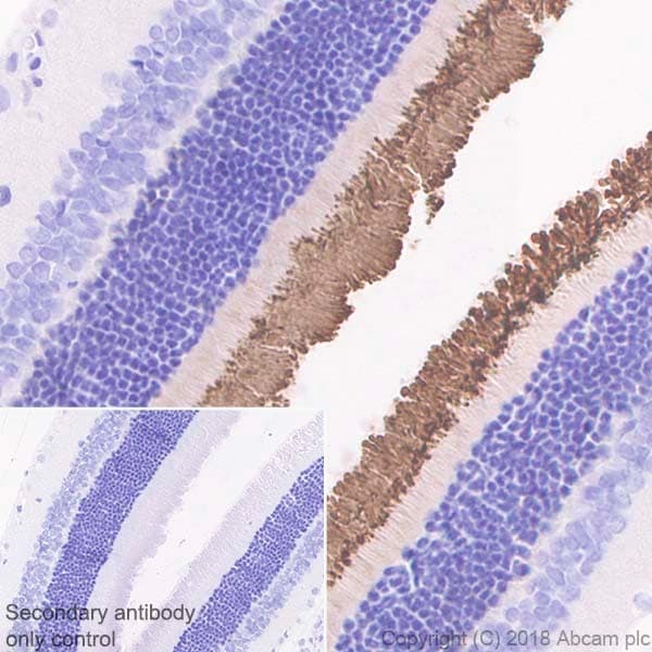Anti-Rhodopsin antibody [EPR21876](AB221664)
