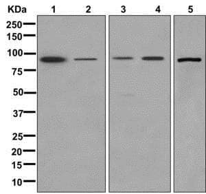 Aldh1l1 Aldh1l2 Antibody Epr12743b Astrocyte Marker Ab177463  Western Blot Img103413