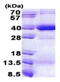 Recombinant Human HLA-C protein(AB167868)