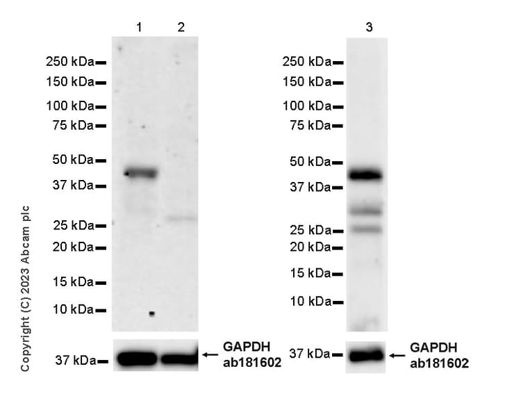 Anti-BRN3A + BRN3B + BRN3C antibody [EPR26313-54](AB317492)