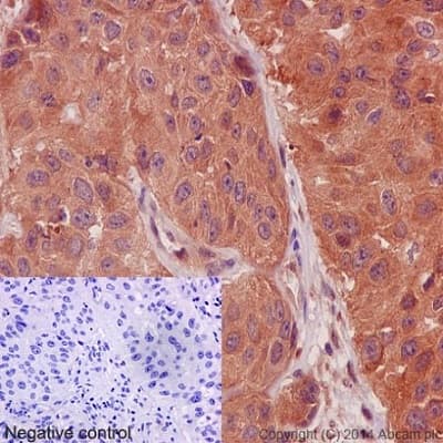 Calpain 1 Antibody Epr3319 Ab108400  Immunohistochemistry Formalin Pfa Fixed Paraffin Embedded Sections Img127748