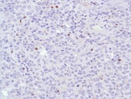 Anti-FOXP3 antibody [SP97](AB99963)