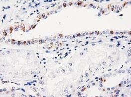 Anti-ITM2B antibody [OTI1C11](AB119044)