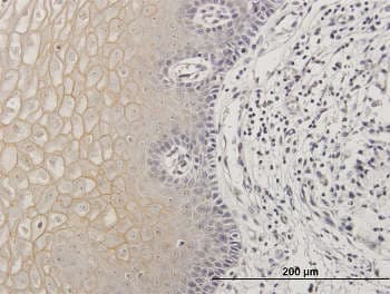 Anti-TGM1 antibody(AB167657)