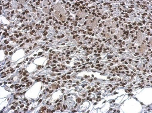 Hmgb1 Antibody N Terminal Ab228624  Immunohistochemistry Formalin Pfa Fixed Paraffin Embedded Sections Img132130