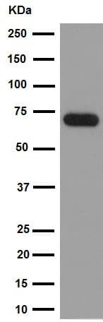 Anti-Choline Acetyltransferase antibody [EPR16590](AB178850)