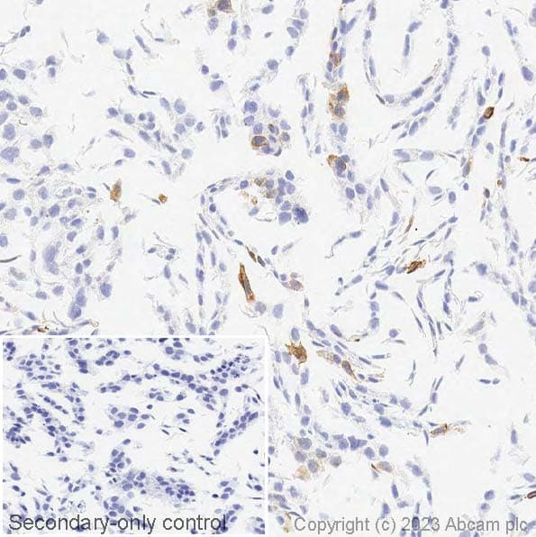 Anti-Cytokeratin 14 antibody [LL002](ab7800)