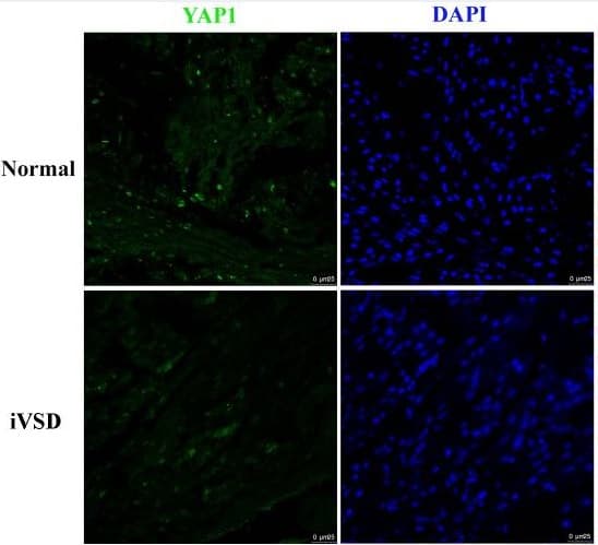 Anti-YAP1 antibody [EP1674Y](AB52771)