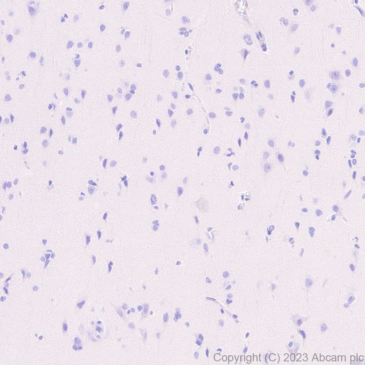 Gentamicin Antibody Epr27991 65 Bsa And Azide Free Ab314127  Immunohistochemistry Formalin Pfa Fixed Paraffin Embedded Sections Img419857