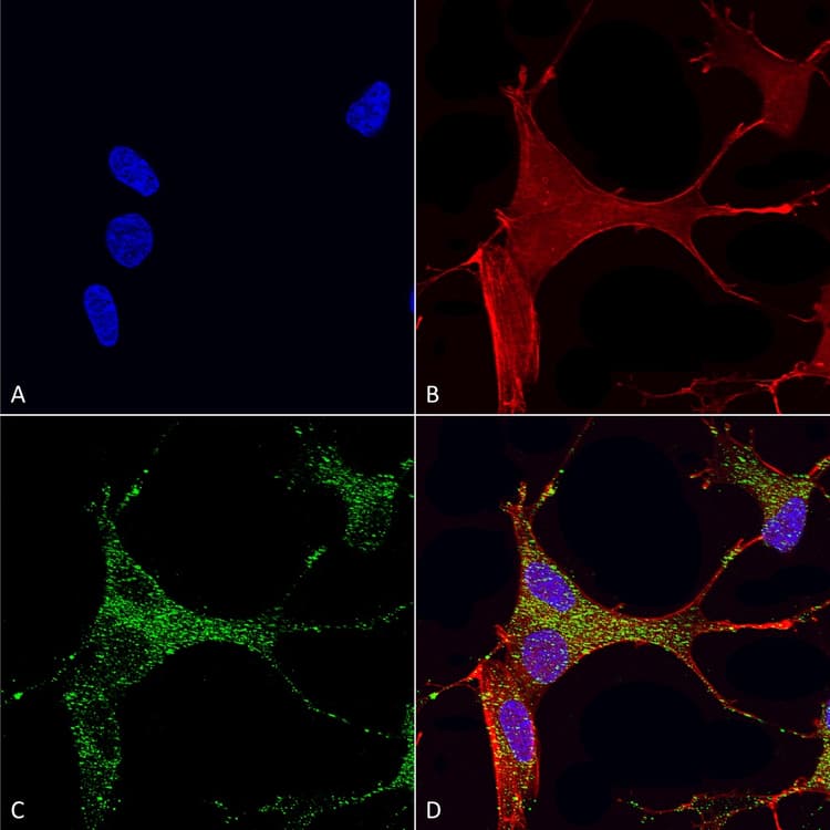 Cacna1g Antibody N178a 9 Ab134269  Immunocytochemistry Immunofluorescence Img438290