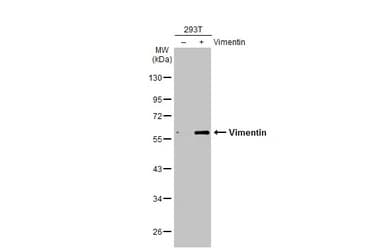 Anti-Vimentin antibody(AB137321)