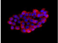 Anti-HERPUD1 antibody [EPR9649](AB150424)