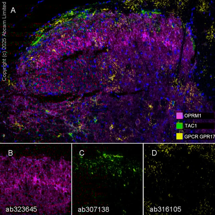 Anti-GPCR GPR17 antibody [EPR26423-34](AB316105)