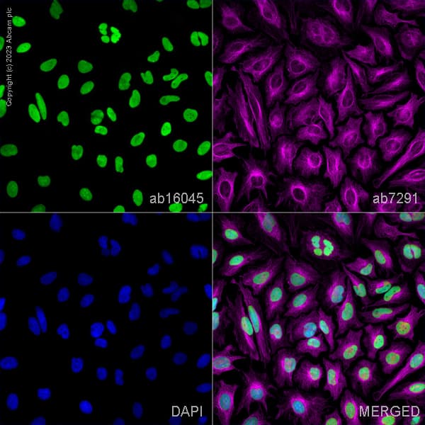 Anti-HMGB1 antibody(AB18256)