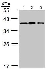 C9orf78 Antibody Ab97644  Western Blot Img88599