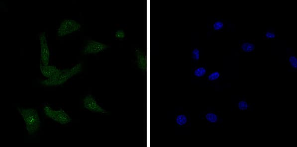 Anti-BANF1/BAF antibody [EPR7668](AB129184)