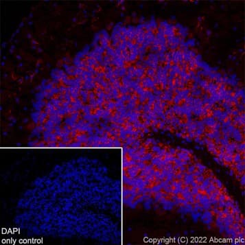 Alexa Fluor® 647 Anti-MAP2 antibody [EPR19691](AB225315)