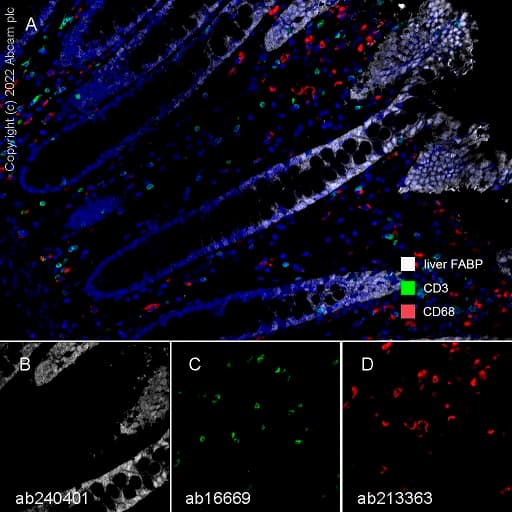 Anti-CD68 antibody [EPR20545](AB213363)