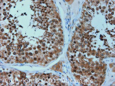 Loxl2 Antibody Ab96233  Immunohistochemistry Formalin Pfa Fixed Paraffin Embedded Sections Img110869